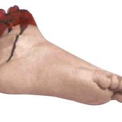 Severed Bloody Foot